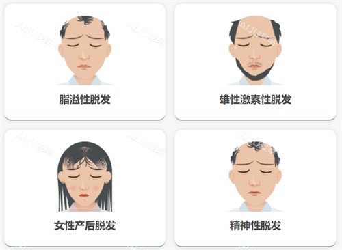 3000单位植发大概多少钱？按单价速算，总费用明细一次看懂！