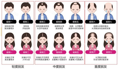 植发一个毛囊单位多少钱？单价10-20元，价格透明无隐形消费！