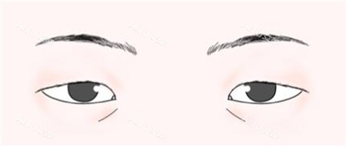 三角眼