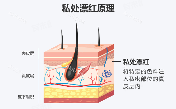 拒绝尴尬！解析菲蜜丽激光漂红原理及成效，附2026用户反馈与预约挂号指南