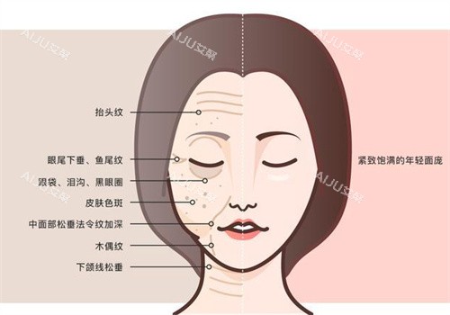 面部抗衰前后