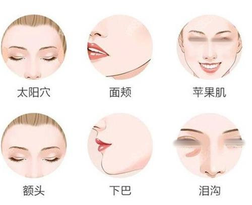 小白必看！微整注射类项目详情介绍，少女针/童颜针/天使针/胶原蛋白可真全呀
