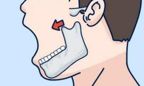 脸太方了怎么办？当然还得看轮廓整形手术：包含适合人群+价格分享