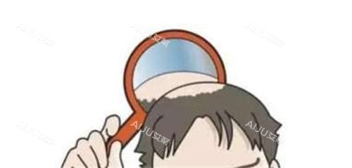 头顶脱发动画示意图 头顶脱发动画示意图