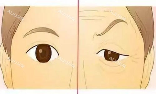 上眼皮下垂动画图片 上眼皮下垂动画图片