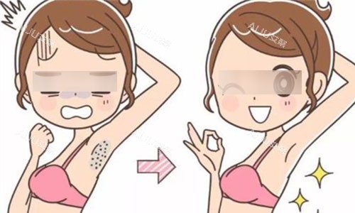 激光脱毛动画图 激光脱毛动画图