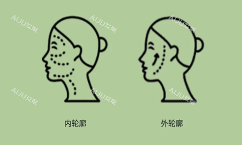 内外轮廓 内外轮廓