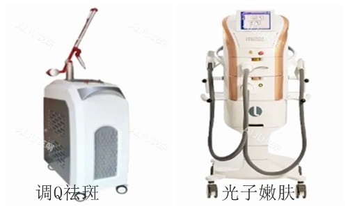 祛斑仪器 祛斑仪器