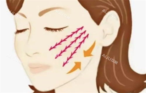 拉皮手术示意图 拉皮手术示意图