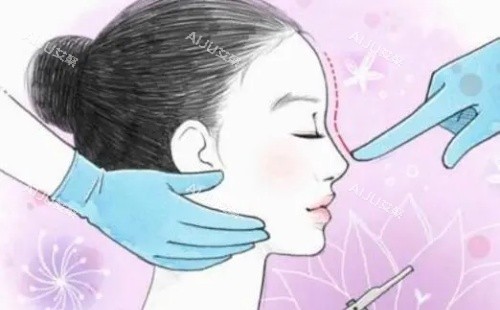 隆鼻示意图 隆鼻示意图