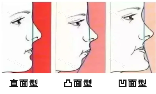 鼻基底对比图 鼻基底对比图