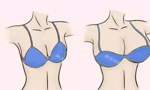 隆胸前后对比动画图 隆胸前后对比动画图