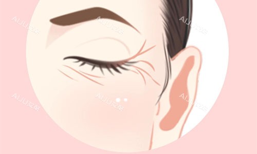 面部皱纹的动画展示图 面部皱纹的动画展示图