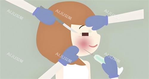 玻尿酸注射图 玻尿酸注射图