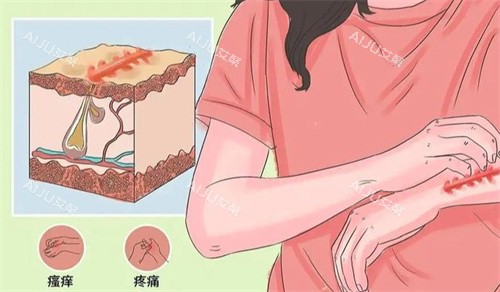 成都去疤痕多少钱？激光去疤痕/针剂去疤/手术去疤/特定疤痕修复的价格这里全都有