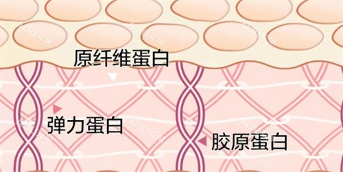 三型胶原蛋白可以填充吗?会不会有后遗症?三型胶原蛋白能填充但需注意感染_艾聚网