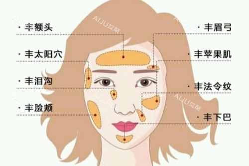 脂肪胶填充面部卡通图