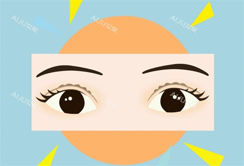 Park法与全切双眼皮对比:手术原理、术后痕迹及维持时间深度剖析_艾聚网
