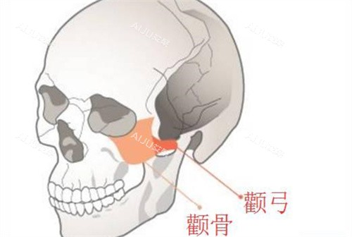 颧骨颧弓手术一般在什么价位?北京&上海&广州&深圳&成都&重庆价格全解析_艾聚网