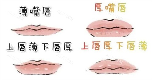 在线查询唇部玻尿酸注射的方法、注射层次、价格及维持时间