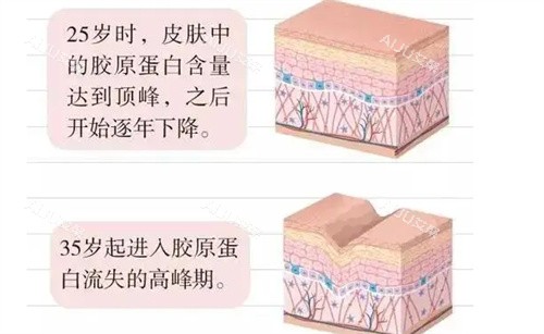 胶原蛋白的变化 胶原蛋白的变化