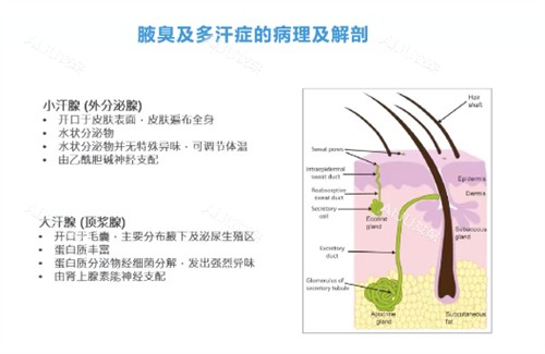 公开2025年在杭州做除腋臭费用，查询激光、注射、手术除腋臭价格！
