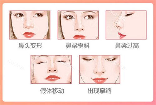 南通隆鼻手术价格表以及靠谱医院公布，俪人连天美/友谊整形医院隆鼻技术价格合理