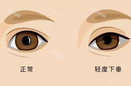 2025沈阳做双眼皮手术价格表+热门医院名单公布：沈阳杏林3680+名流4000+美莱2000+