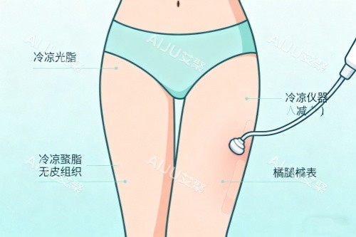 腿部做吸脂卡通图一览
