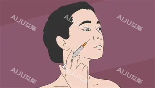 面部注射图
