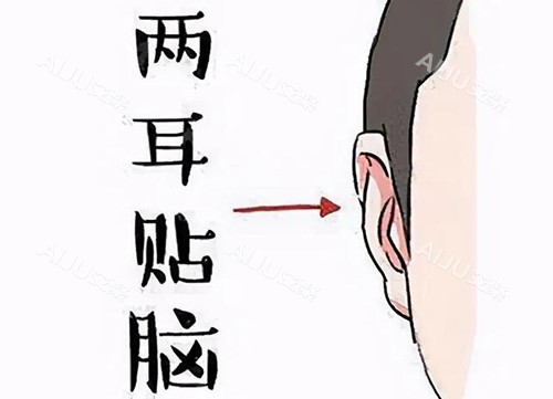 耳朵内贴反骨耳