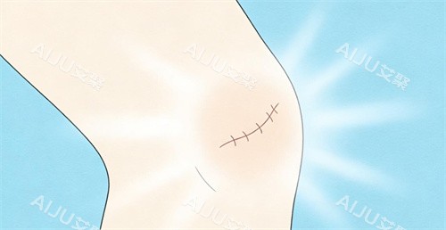 疤痕修复卡通展示照片