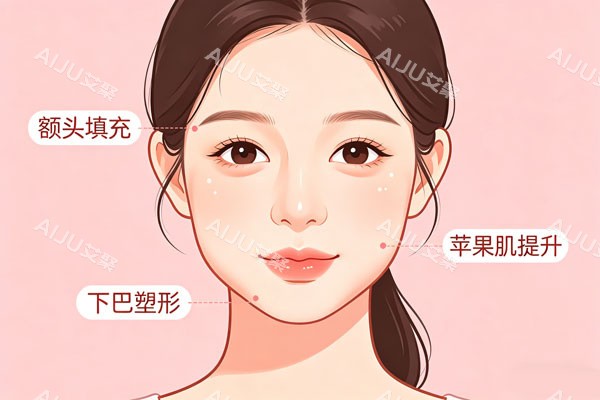 玻尿酸面部提升示意图