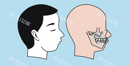 凸嘴的图片