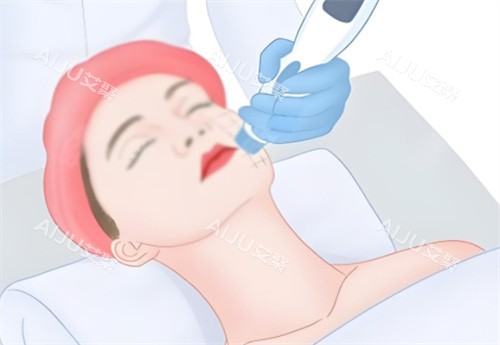面部热玛吉