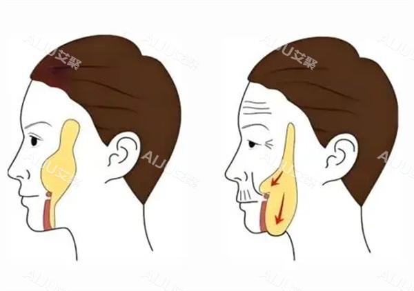 面部轮廓整形卡通图片