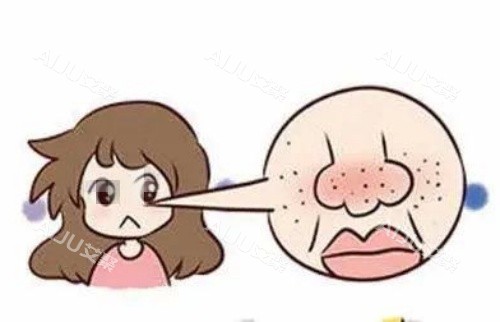 鼻子部位毛孔粗大示意图