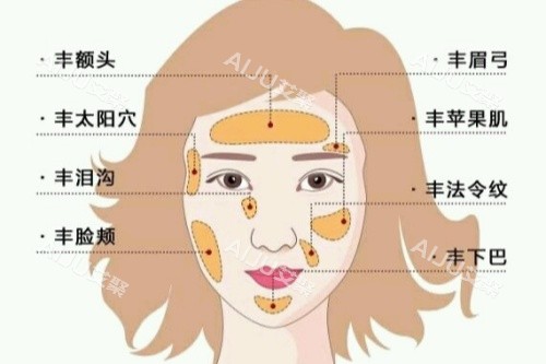 自体脂肪面部填充卡通图