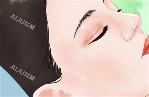 需要双眼皮修复的眼睛