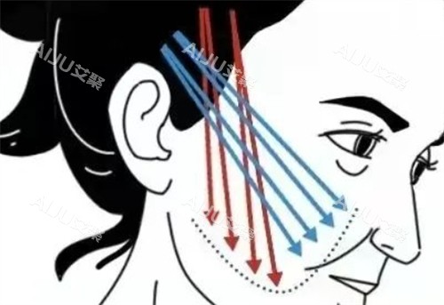 中下面面部提升的位置