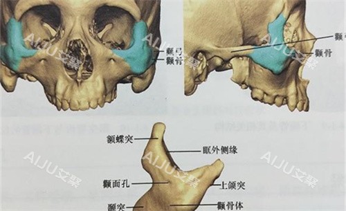罗金超颧骨内推做得怎么样？技术院长亲自主刀，双L截骨+双重上提，打造自然韩系小脸！