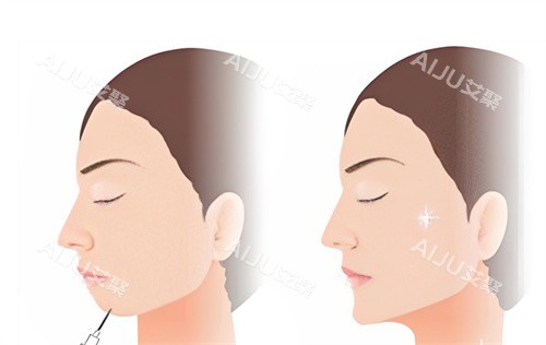 林智贤医生在联合丽格怎么样？技术审美双在线，注射微雕抗衰口碑好！
