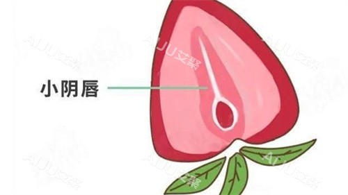 小阴唇整形 小阴唇整形
