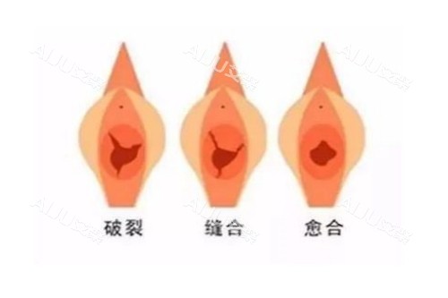 私密整形治疗图片展示