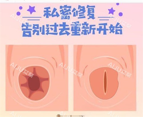处女膜修复前后对比图