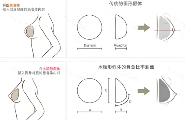 隆胸假体形状对比