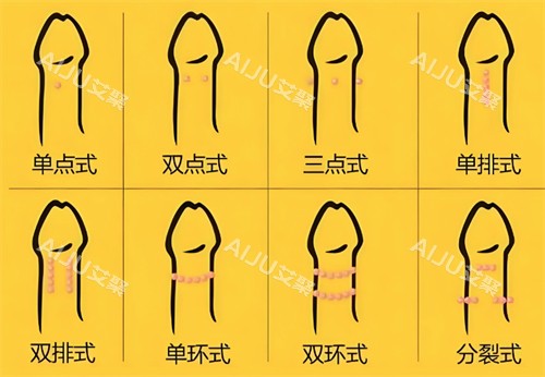 入珠的不同形式