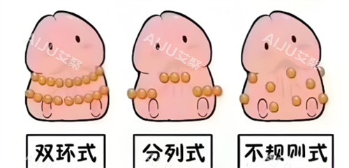 入珠手术动画3