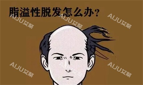 脂溢性脱发怎么办