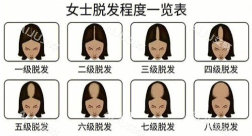 植发询问24小时在线！快速获取机构推荐/价格对比/术例查看/医生预约，留电即回！
